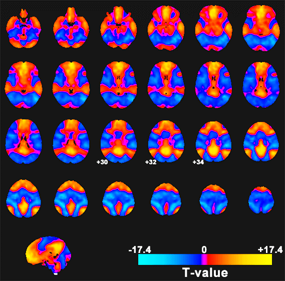 Default network map produced by BASH-rs-fcMRI.