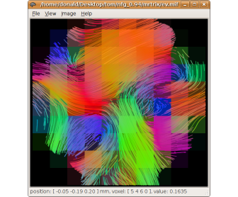 Example use - DT deterministic streamlines (using MRtrix)