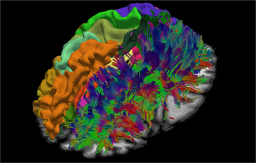 Rendering of brain analysis with JIST Tools.