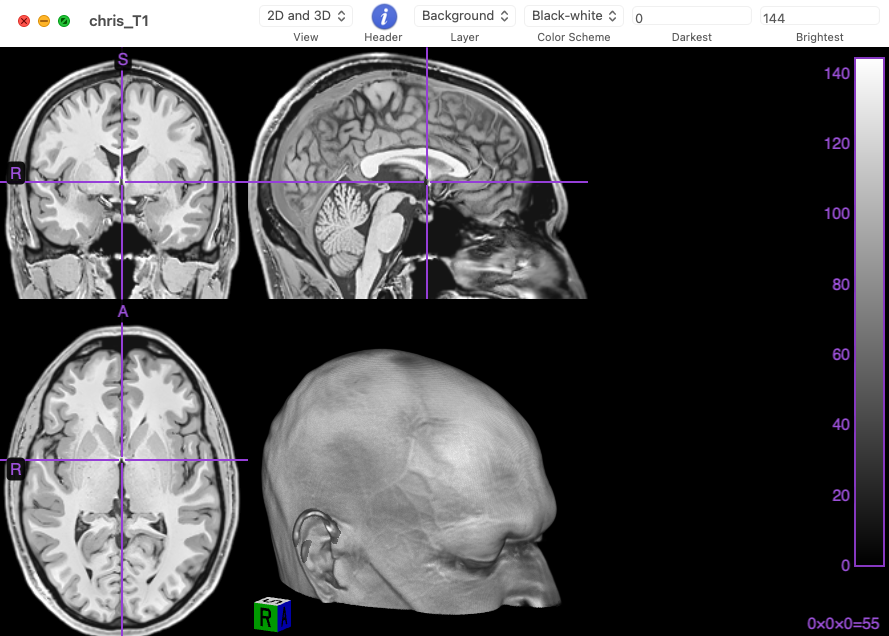 MRIcro viewing a T1 scan