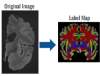 Label map derived from high-resolution ex vivo MRI