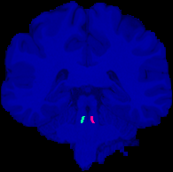 Manually annotated locus coeruleus labels