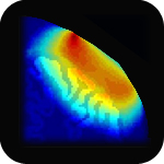 Diffuse Optical Tomography