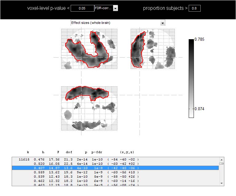 voxel-based subject-specific analyses