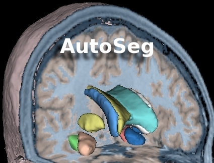 AutoSeg Logo