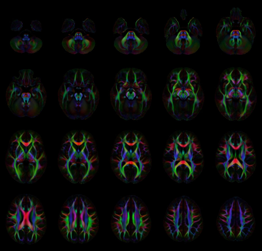 Diffusion anisotropy color maps generated from mean tensors