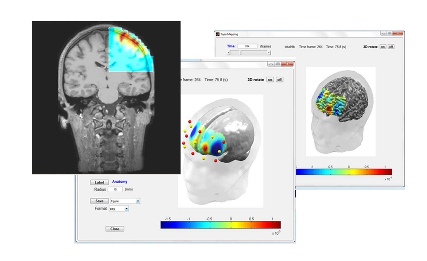 NIRx NIRS Imaging Software