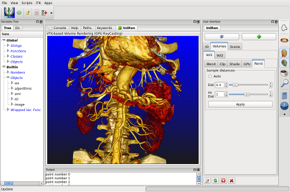 Volume Rendering of abdominal CTA