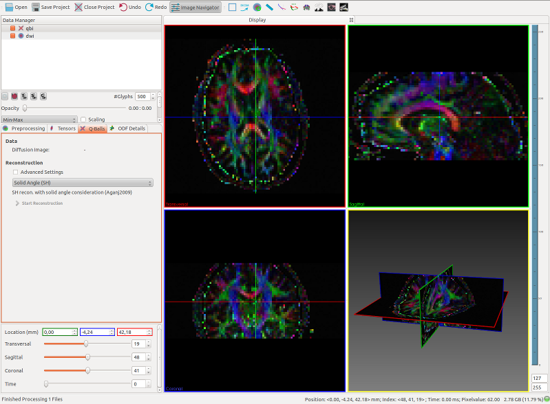 Q-Ball reconstruction and image visualization