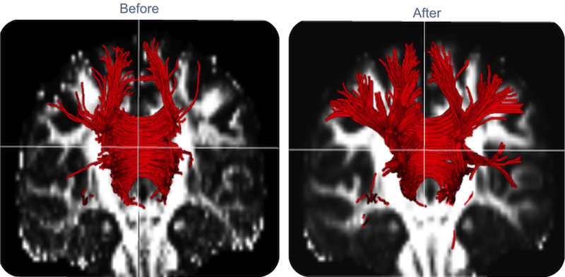 Multi-resolution NLM