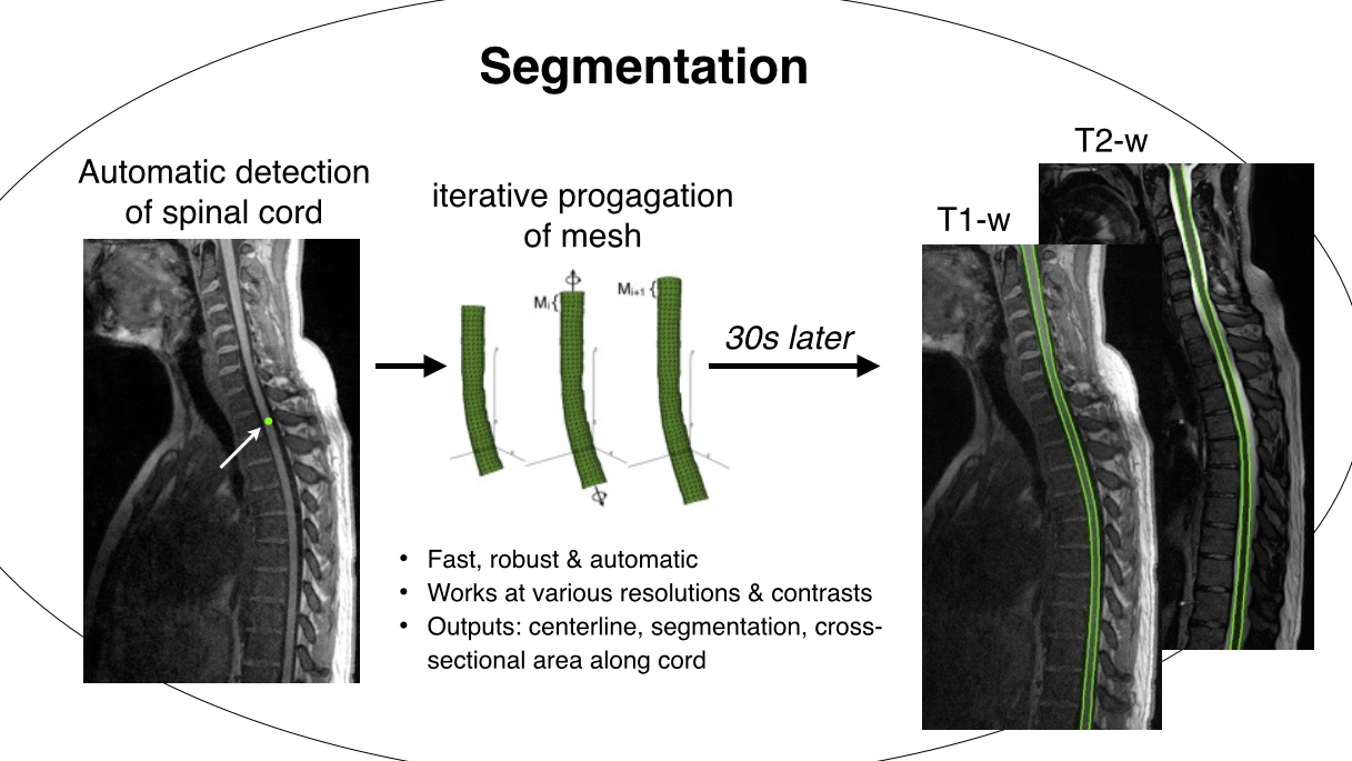 Segmentation