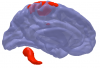 Cerebellar and motor activation