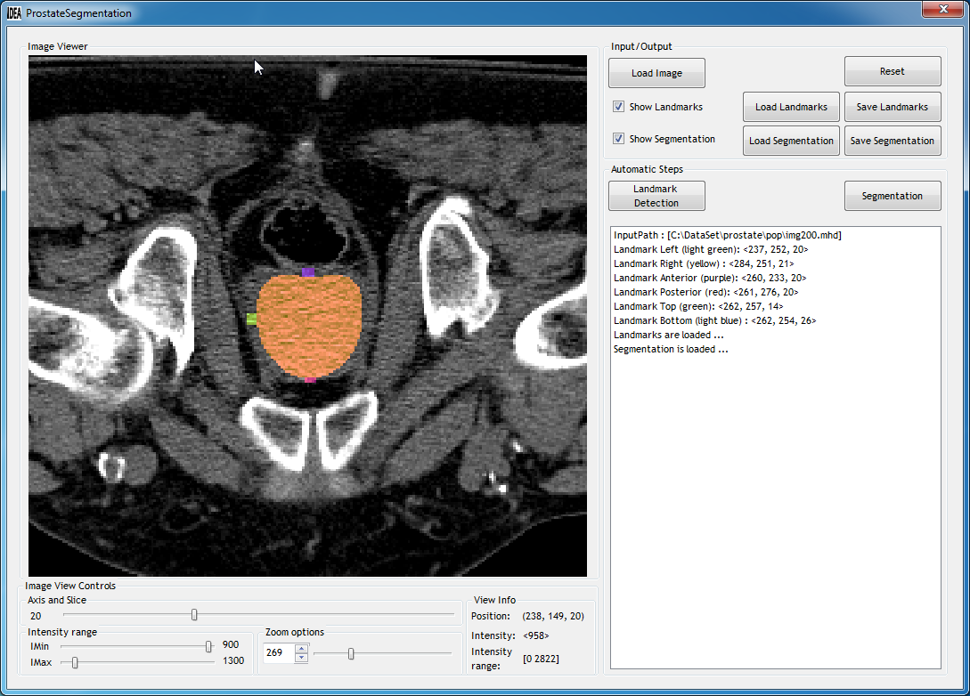 proCTSeg software