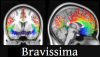Graphic for Bravissima: Human Brain Artery NIfTI Atlas